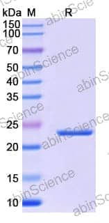 Recombinant Mouse PGF/PlGF/PLGF Protein, N-His-SUMO