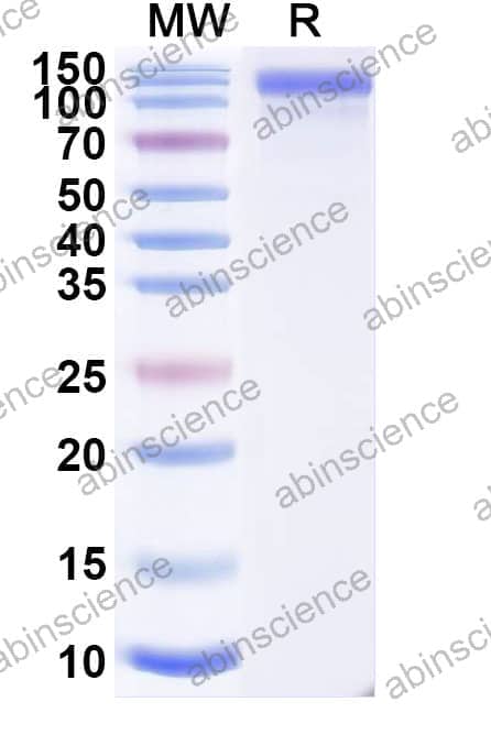 Recombinant Mouse CD309/KDR/VEGFR-2 Protein, C-His
