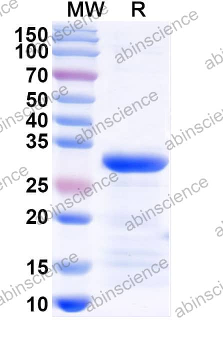 Recombinant Mouse CD79β/CD79B Protein, C-His