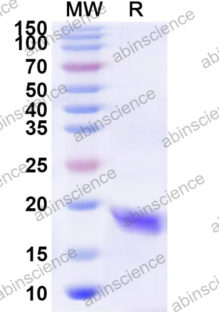 Recombinant Mouse Ki67/MKI67 Protein, N-His