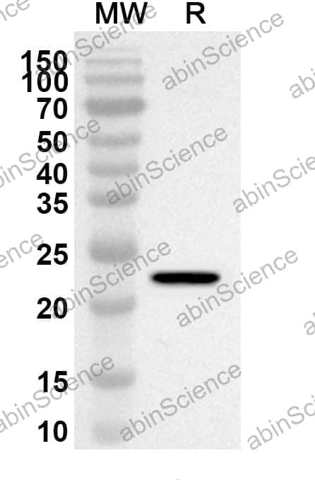 Anti-Mouse DCC Polyclonal Antibody