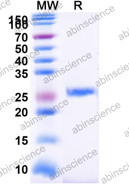 Recombinant Mouse CD49a/ITGA1/VLA-1 Protein, N-His