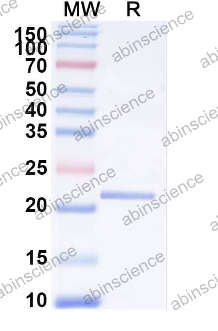 Recombinant Mouse IL4 Protein, N-His-SUMO