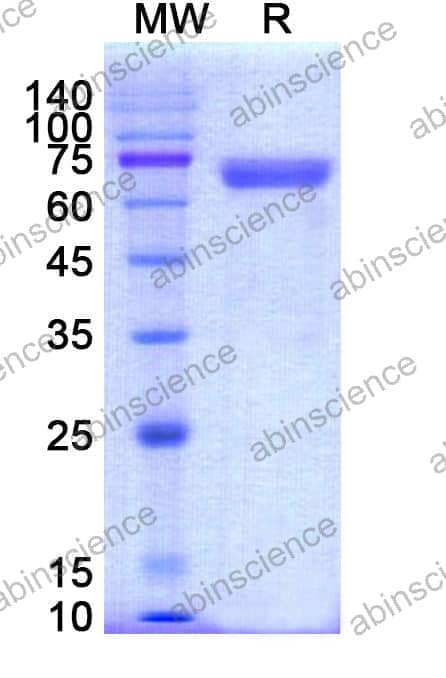 Recombinant Mouse CD126/IL6R/IL-6RA Protein, C-Fc