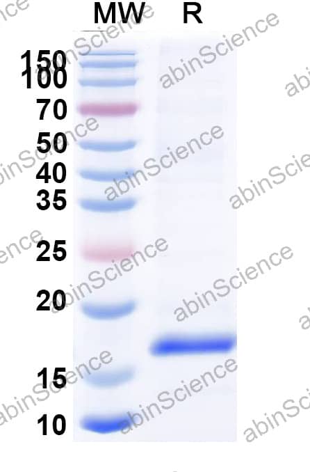 Anti-Bet v 1/Allergen Bet v I-A Nanobody (SAA0668)