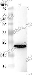 Anti-Bet v 1/Allergen Bet v I-A Nanobody (SAA0668)