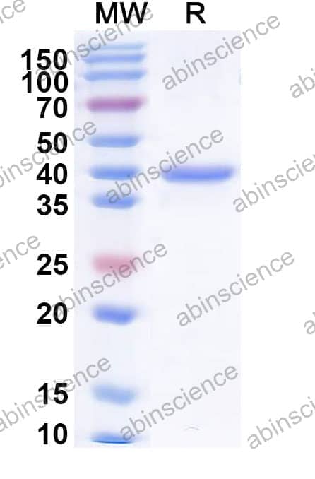 Recombinant Juniperus chinensis Sab c 1 Protein, N-His