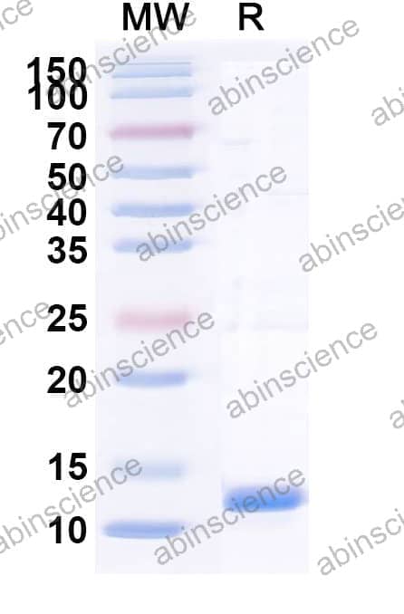 Recombinant Peach Pru p 1/Pru p 3 Protein, C-His