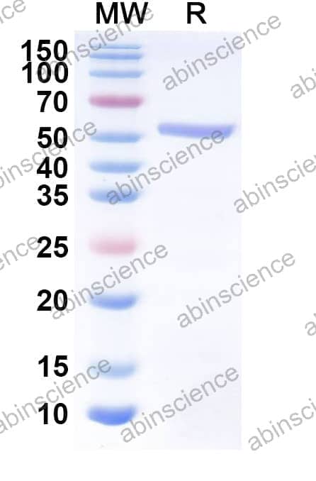 Recombinant Peanut Ara h 1 Protein, N-His & C-Avi