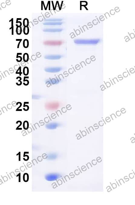 Recombinant Peanut Ara h 1 Protein, N-His