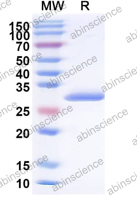 Recombinant Common timothy PHLPI/Allergen Phl p I Protein, N-His