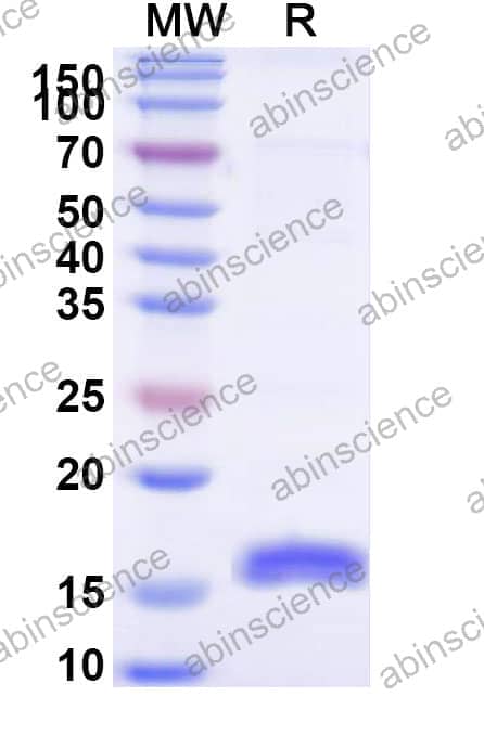 Recombinant Betula pendula BETVII/Allergen Bet v II Protein, N-His