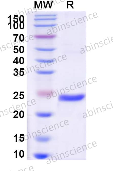 Recombinant Rat FGF15 Protein, N-His