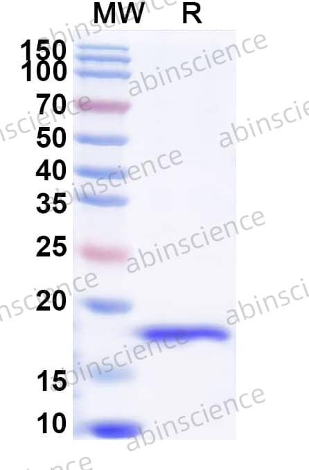 Recombinant Rat TGFB1/TGF-beta-1 Protein, N-His