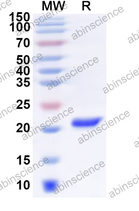Recombinant Pig IL10 Protein, N-His