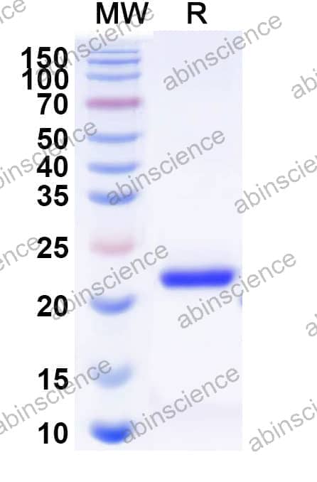 Recombinant Sindbis virus(SINV) nsp4 Protein, N-His