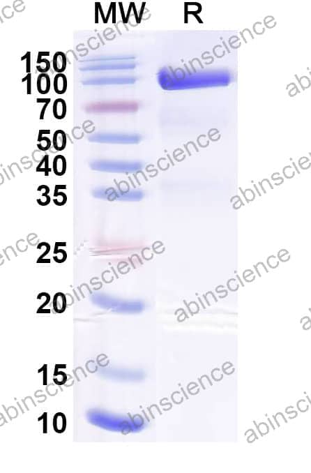 Recombinant Sindbis virus(SINV) Spike glycoprotein E1, C-Fc