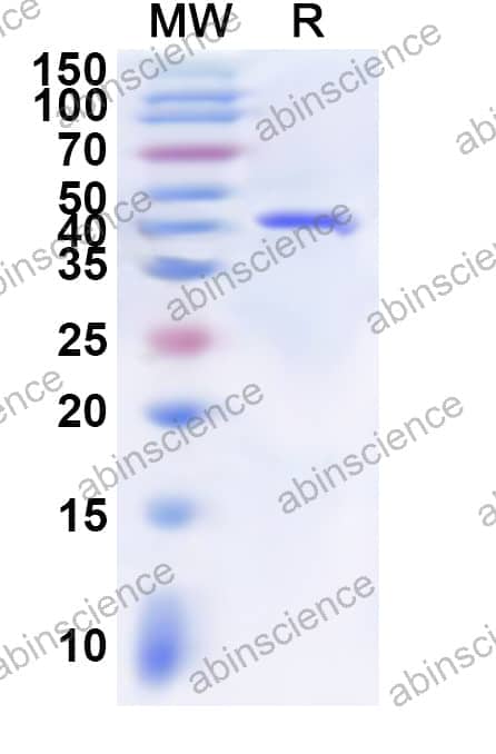 Recombinant Sindbis virus(SINV) Spike glycoprotein E2, N-His
