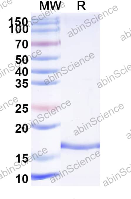 Anti-HPIV-3 Fusion glycoprotein F0 Recombinant Nanobody (SAA2258)