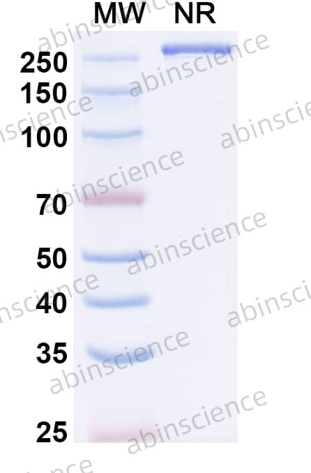 Anti-VEEV Spike glycoprotein Antibody (SKV16)
