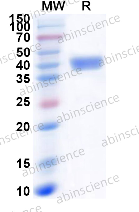 Recombinant HSV1/HHV-1 glycoprotein D/gD Protein, N-GST&C-His