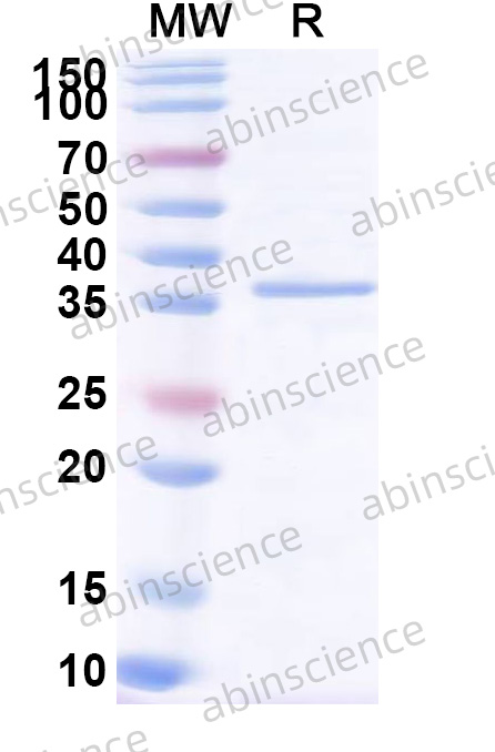 Recombinant HPV58 E7 Protein, N-GST & C-His