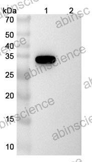 Anti-Norovirus/Norwalk virus Capsid protein/VP1 Recombinant Antibody (Nano-4)