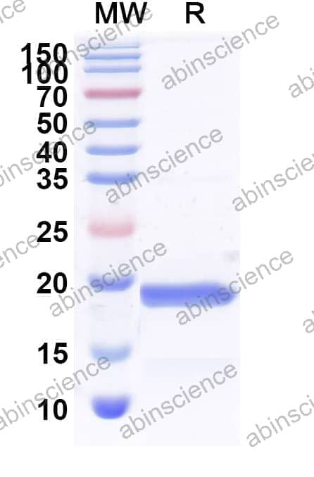 Recombinant HPV B19 VP1/Coat protein VP1 Protein, N-His