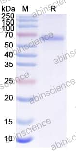 Recombinant CDV Protein N/Nucleoprotein Protein, N-His