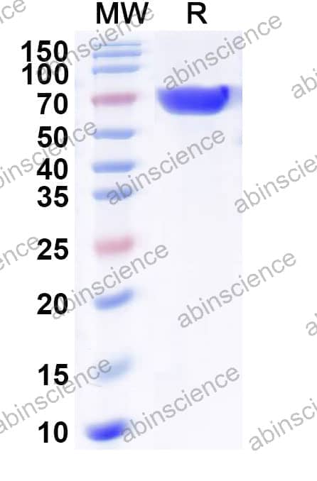 Recombinant Influenza A virus (H10N5) NA/Neuraminidase Protein, C-His