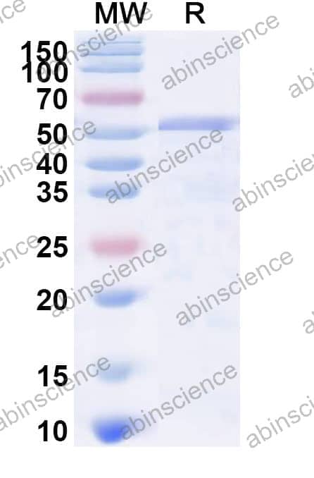Recombinant Influenza A virus (H10N7) NA/Neuraminidase Protein, N-His