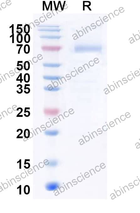 Recombinant Influenza A virus (H10N7) NA/Neuraminidase Protein, C-His