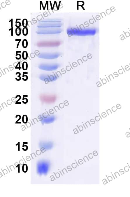 Recombinant Influenza A virus (H10N7) NA/Neuraminidase Protein, C-Fc