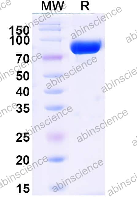 Recombinant Influenza B virus (Flu B) NA/Neuraminidase Protein, N-Fc