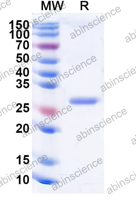 Recombinant Influenza A virus (H16N3) HA/Hemagglutinin Protein, N-His