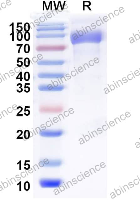 Recombinant Influenza A virus (H1N1) HA/Hemagglutinin Protein, C-His