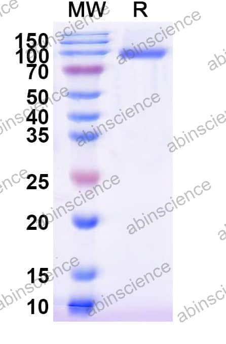Recombinant Influenza A virus (H1N1) HA/Hemagglutinin Protein, C-His