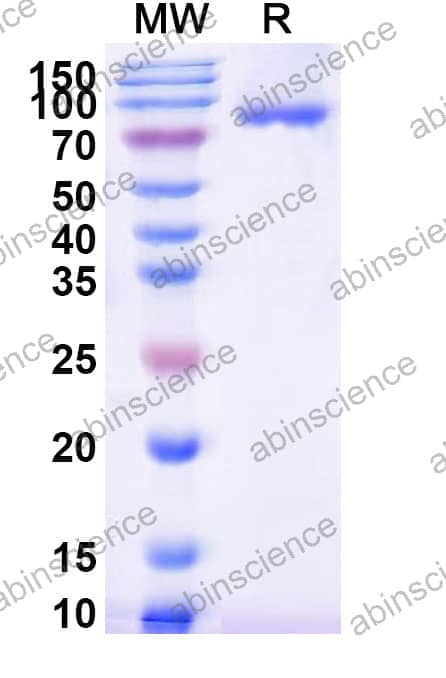 Recombinant Influenza A virus (H1N1) HA/Hemagglutinin Protein, C-His