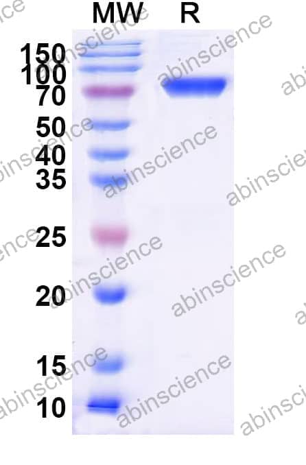 Recombinant Influenza A virus (H1N1) HA/Hemagglutinin Protein, C-His