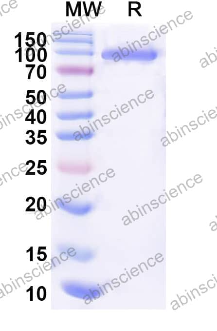 Recombinant Influenza A virus (H7N7) HA/Hemagglutinin Protein, C-His