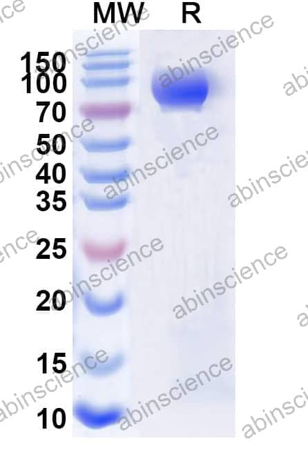 Recombinant Influenza A virus (H10N7) HA/Hemagglutinin Protein, C-His