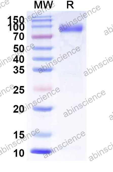 Recombinant Influenza A virus (H12N5) HA/Hemagglutinin Protein, C-His