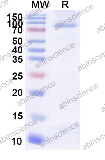 Recombinant Influenza A virus (H13N8) HA/Hemagglutinin Protein, C-His
