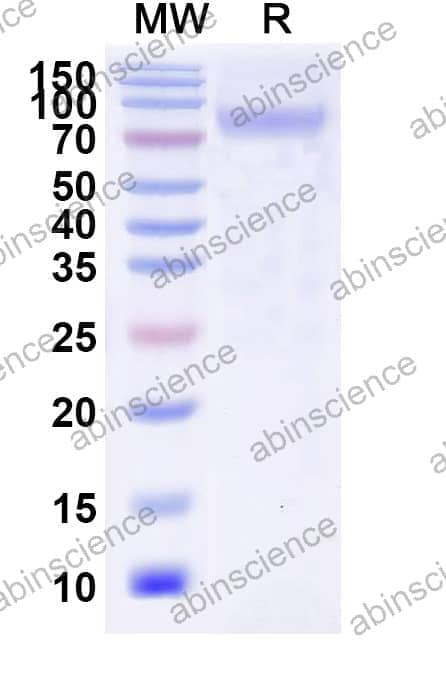 Recombinant Influenza A virus (H14N6) HA/Hemagglutinin Protein, C-His