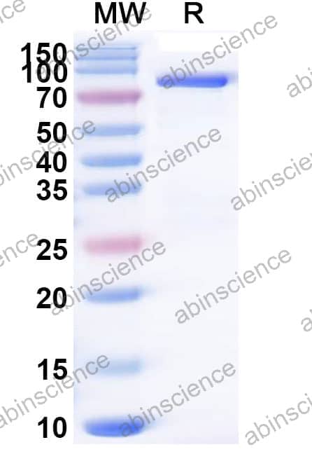 Recombinant Influenza A virus (H16N3) HA/Hemagglutinin Protein, C-His
