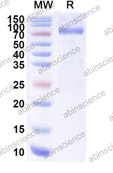 Recombinant Influenza A virus (H17N10) HA/Hemagglutinin Protein, C-His