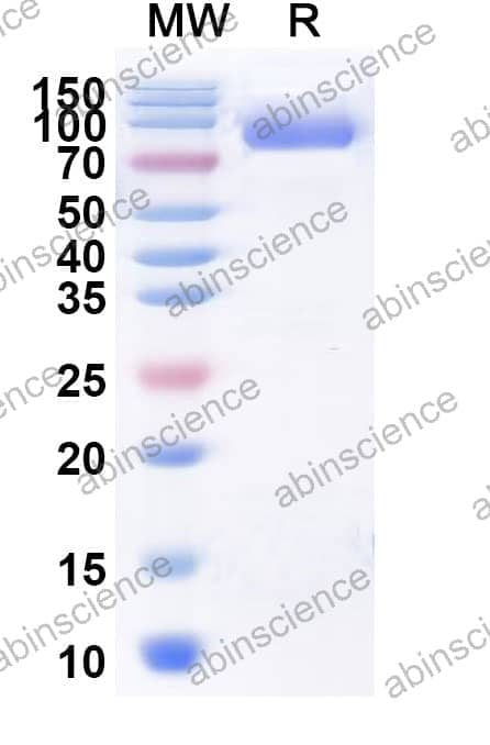 Recombinant Influenza A virus (H8N4) HA/Hemagglutinin Protein, C-His