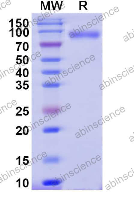 Recombinant Influenza B virus (Flu B) HA/Hemagglutinin Protein, C-His