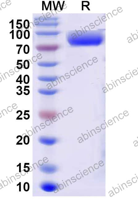 Recombinant Influenza B virus (Flu B) HA/Hemagglutinin Protein, C-6His
