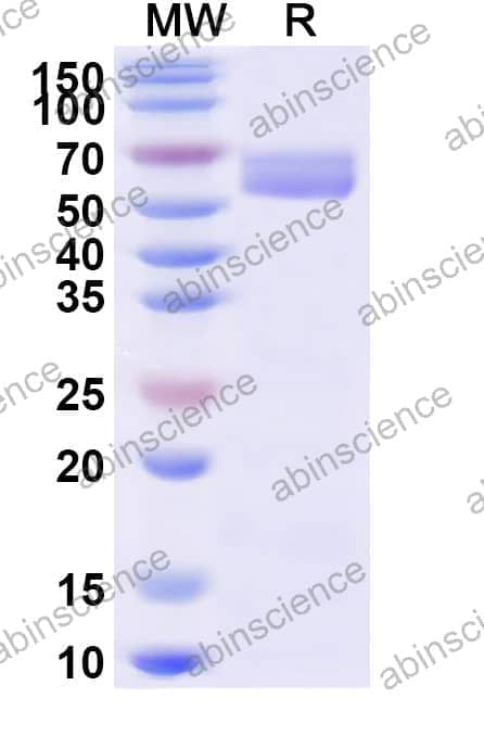 Recombinant West Nile Virus/WNV NS1 Protein, C-His